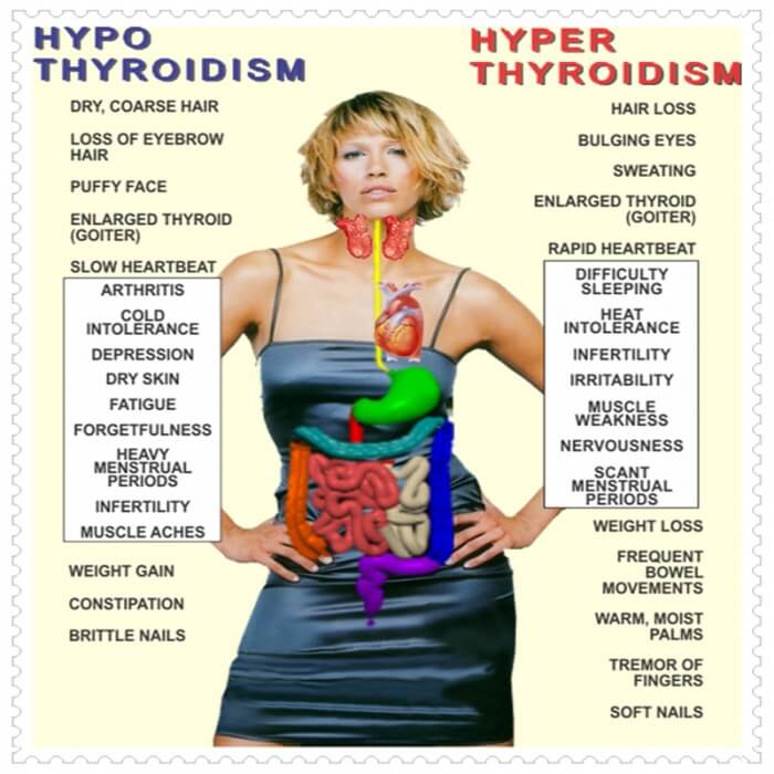 Thyroid Dysfunction - Healthy Fitness Tips Training Routine Body