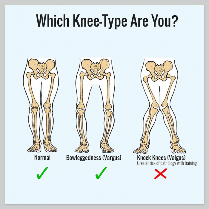 Which Knee-Type Are You? Left Is The Safest, Whilst Right Is..